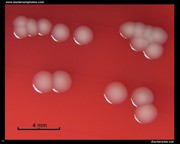 gamma-hemolysis